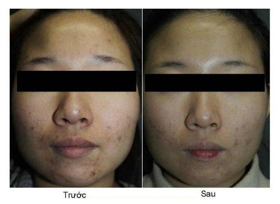 Kết quả thực tế